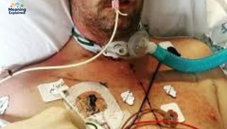 The Complete Story of James Roday Heart Attack